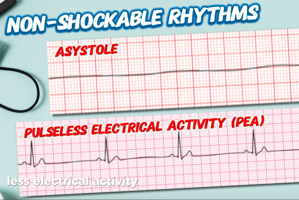 Non-Shockable